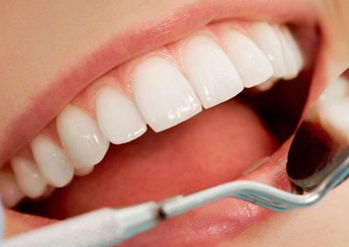 ¿Despiertas con dolor de mandíbula o dolor de cabeza? Podrías estar apretando los dientes mientras duermes