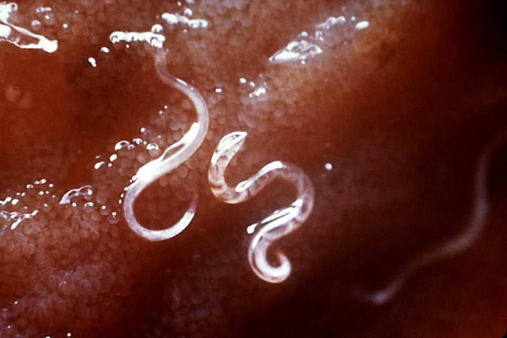 Medicamentos para eliminar parasitos intestinales en adultos