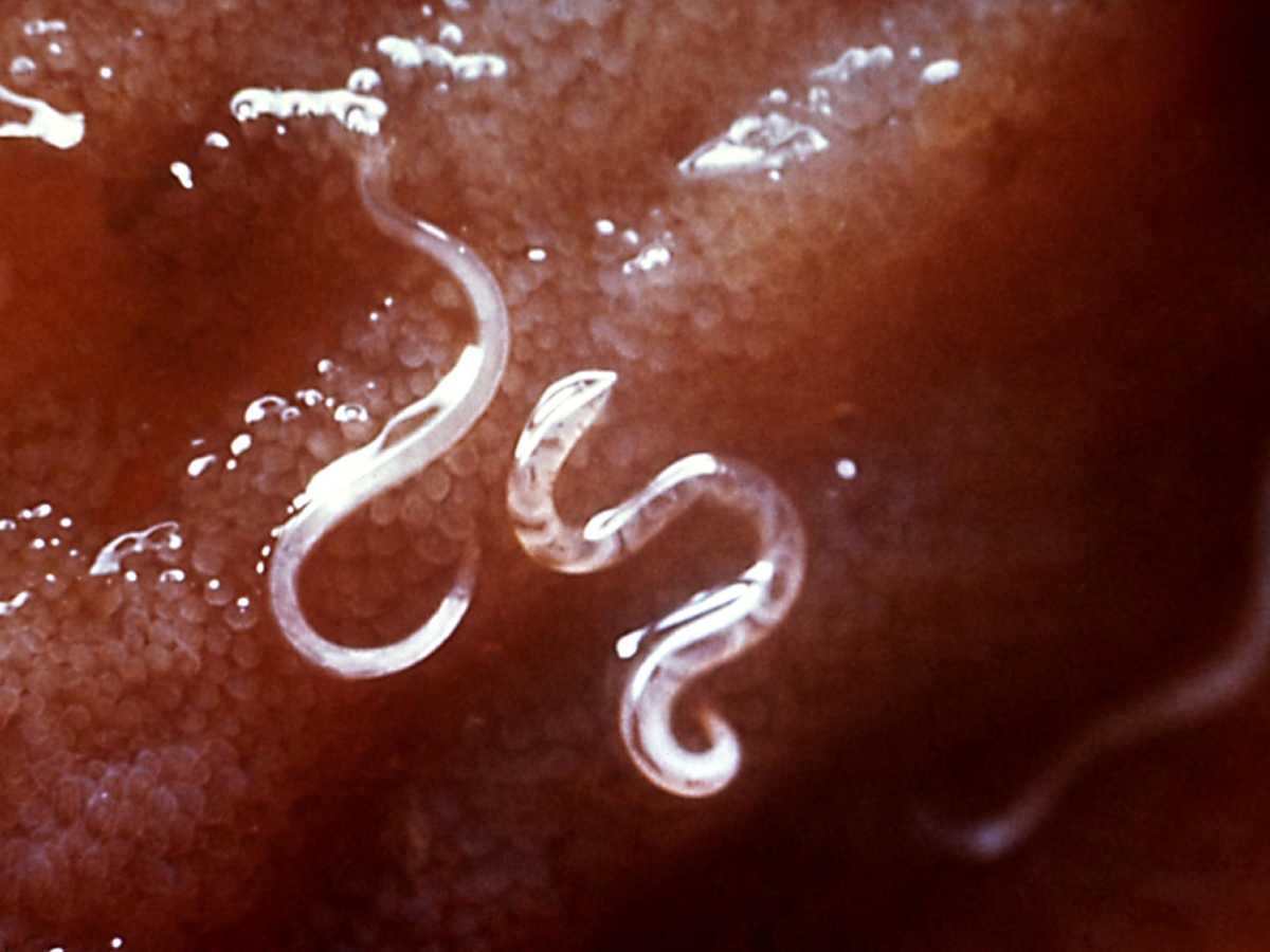 buenos parásitos en el cuerpo humano