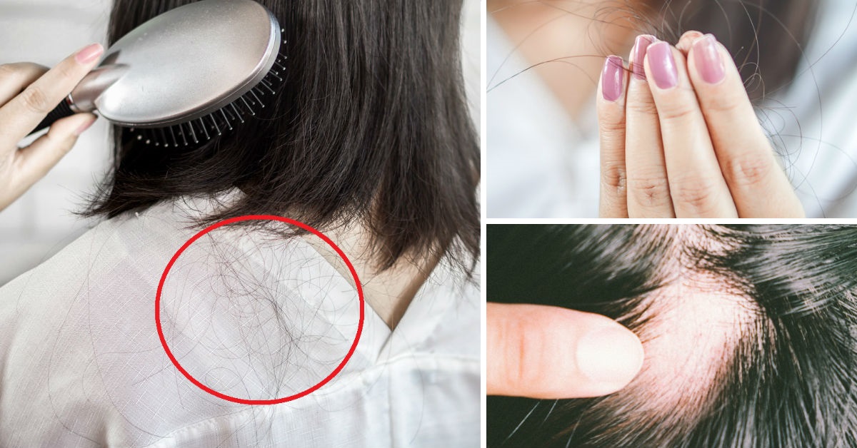 Cambios en el cuerpo que consideramos insignificantes y revelan enfermedades graves Es normal perder aproximadamente hasta 100 cabellos al día, lo que no es normal es que mientras te bañas notes bolas de cabello en la coladera o que se caiga a puños mientras lo peinas.