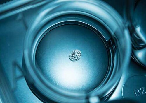 Equipo Technion desarrolla implante 3D que imita tejido humano perdido