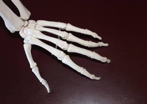 Un fármaco antiepiléptico aprobado por la FDA puede ayudar a revertir el daño por osteoartritis